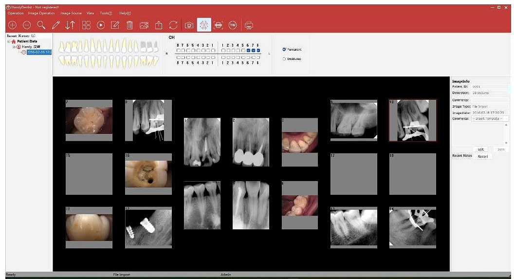 HandyDentist Software — menú de radiografías y fotografías intraorales