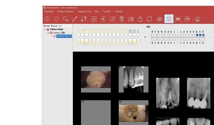 HandyDentist Software — radiografías y fotografías intraorales